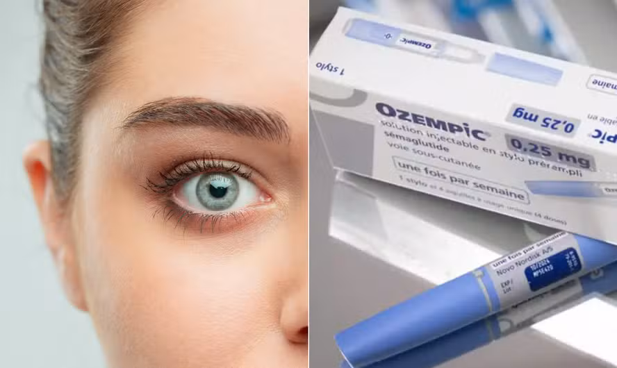 Ozempic e Wegovy podem causar casos raros de doença ocular grave, confirma investigação da agência europeia