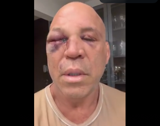 FireShot Capture 315 - Wanderlei Silva atualiza estado de saúde após briga generalizada e _ - [esportes.r7.com].png