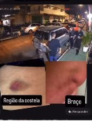  Imagens desmentem baterista e confirmam agressão contra cantora em Natal