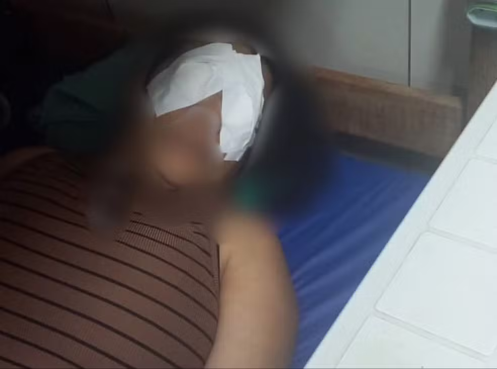 Servidora sofre queimadura na córnea após uso de produto químico no hospital Walfredo Gurgel