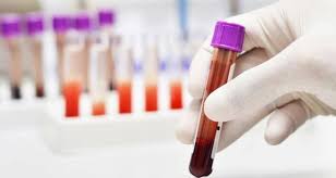 exame de sangue