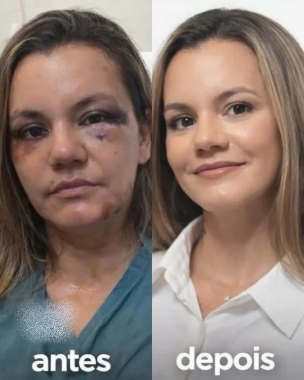 juliana-soares-antes-e-depois.webp