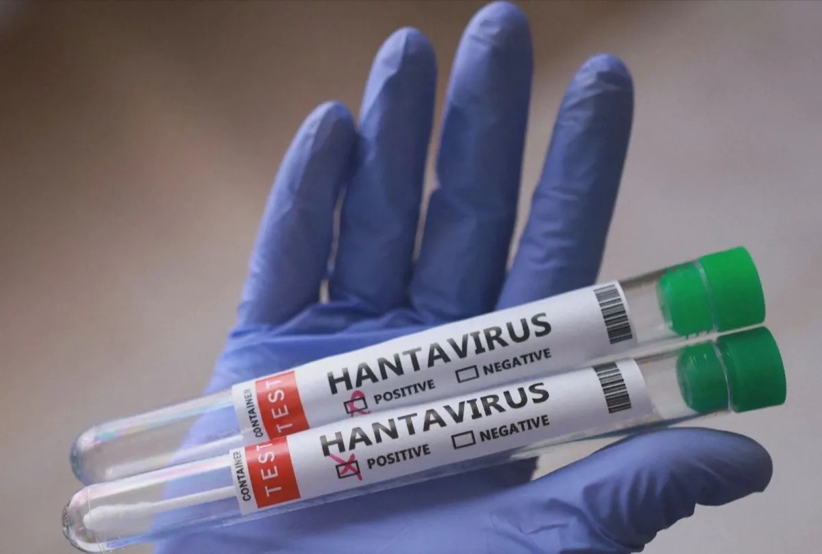 Tubos de ensaio com amostrar do hantavírus, que atingiu um cruzeiro de luxo  • REUTERS