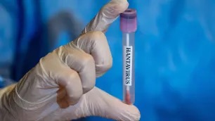 Hantavirus | cnn brasil