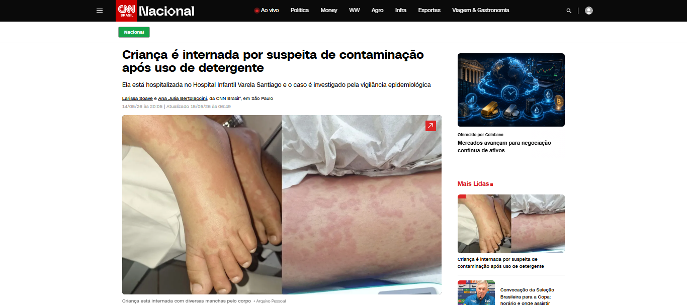 FireShot Capture 1401 - Criança é internada por suspeita de contaminação após uso de deter_ - [www.cnnbrasil.com.br].png