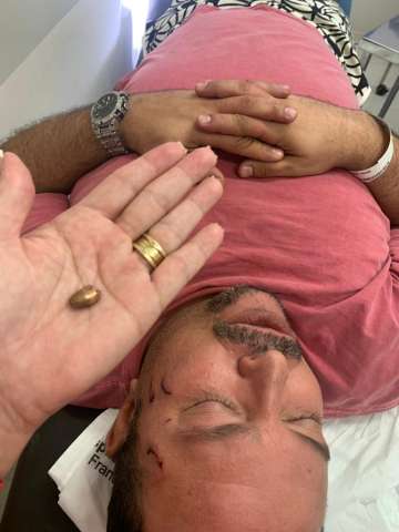 [VÍDEO] Turista vítima de assalto em Pipa desabafa