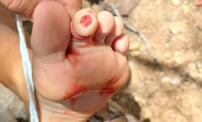 Piranhas atacam banhistas de rio no interior do RN; Prefeitura divulga alerta