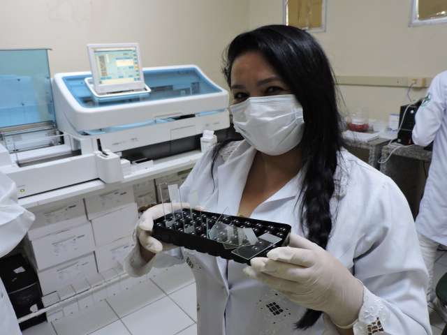 Laboratório Central alerta quem está com sintomas gripais deve fazer o exame de Covid 19