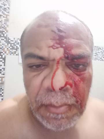 Motorista de banda Cavaleiros de Forró e assaltado e agredido por bandidos na zona Norte