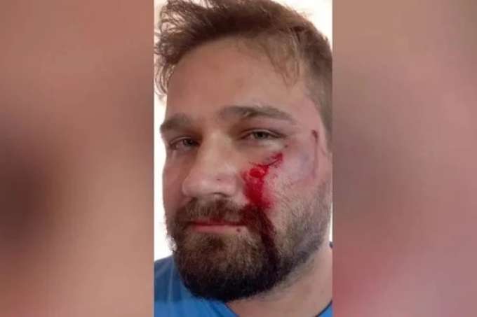 Médico é agredido com capacete após negar atestado para adolescente