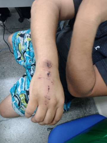 Ladrão cadeirante morde vítima antes de ser preso com armas e joias roubadas no RN