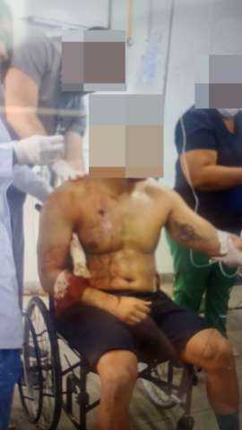 [FOTO] Imagem forte: PM que atirou em si mesmo em frente a academia é atendido no Walfredo Gurgel 