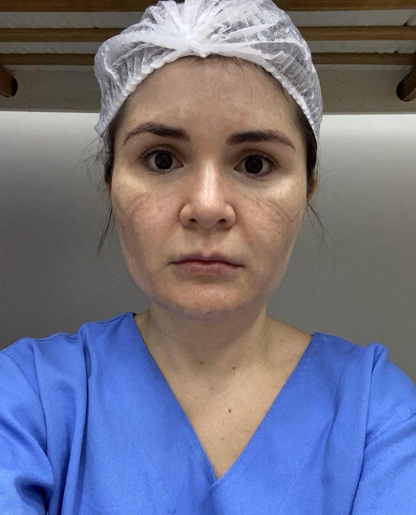 Pacientes de Manaus: Depoimento emocionado de médica do Onofre Lopes