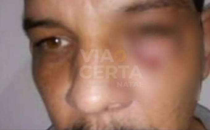 Passageiro se recusa a colocar cinto e agride motorista de aplicativo em São Gonçalo do Amarante