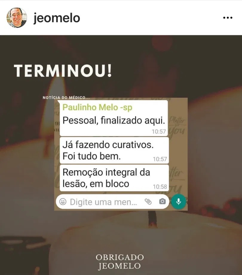 “Foi tudo bem”, informa filho de Geraldo Melo após cirurgia do pai