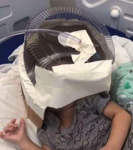 No RN, hospital usa embalagem de bolo como máscara de oxigênio em bebê de 3 meses que esperava UTI